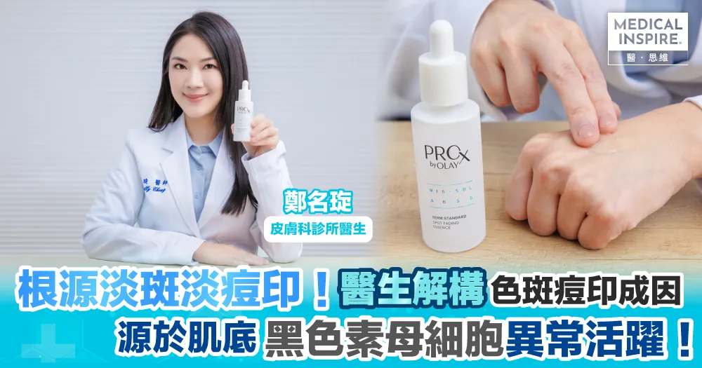 如何淡化色斑並預防新斑生成？十年皮膚科醫生完整教學，告別惱人斑點！