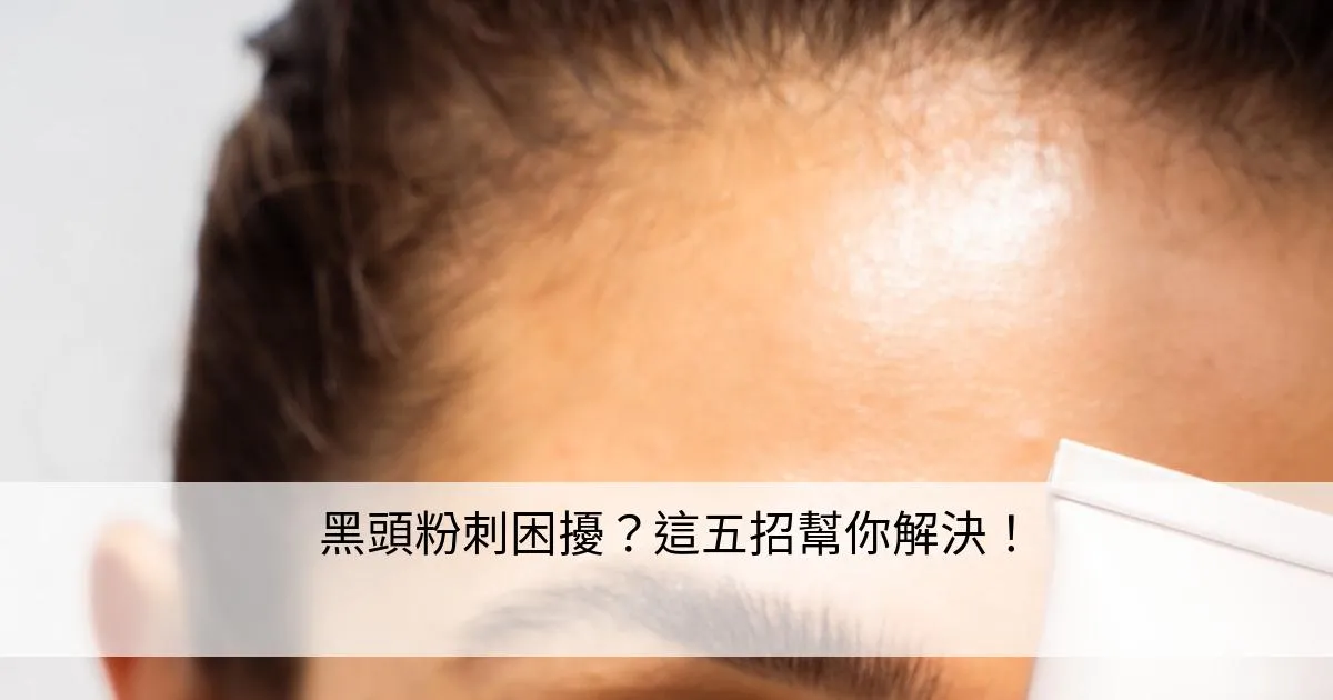 如何針對黑頭問題進行深層清潔?高效解決黑頭困擾的完整教學