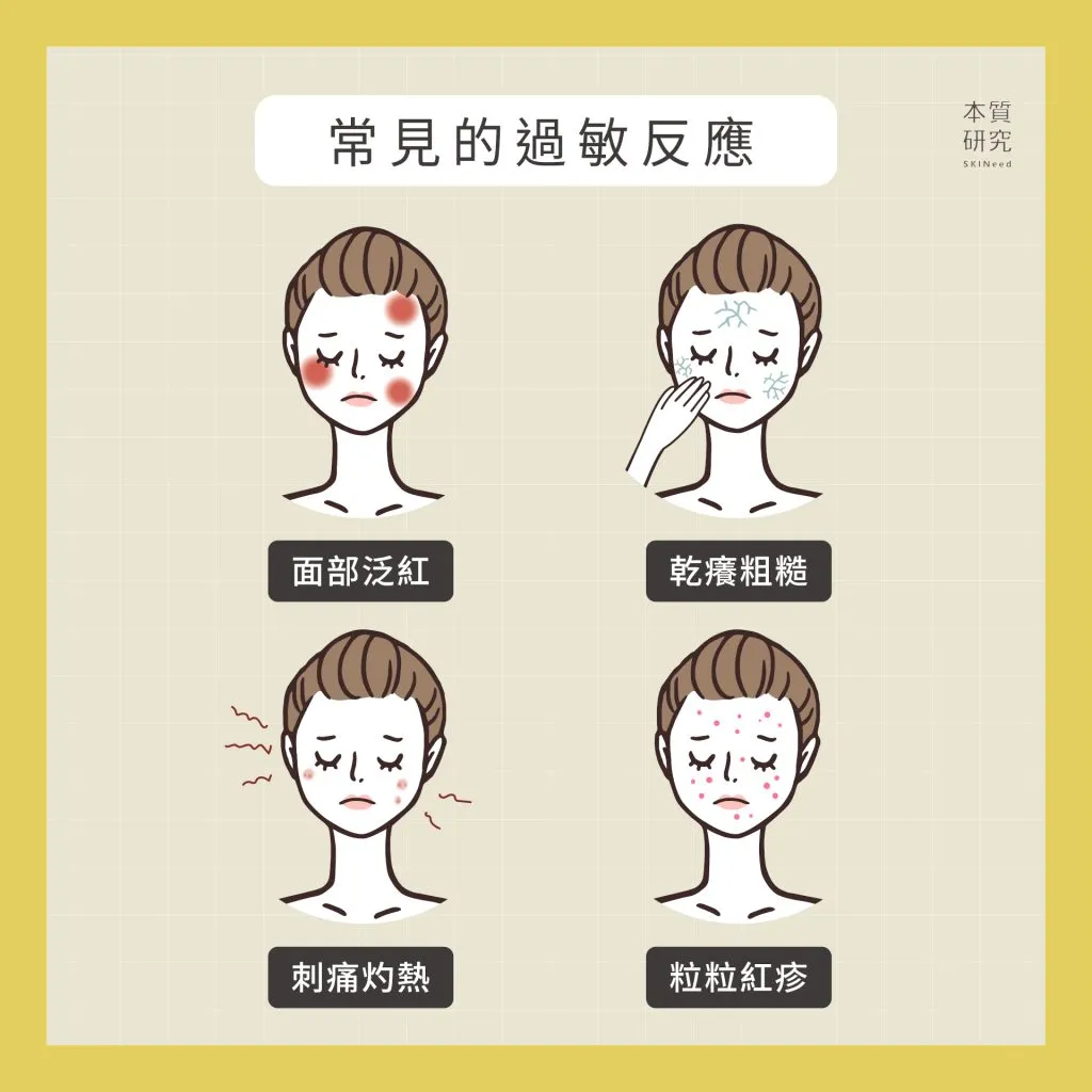 如何避免化妝品過敏反應？