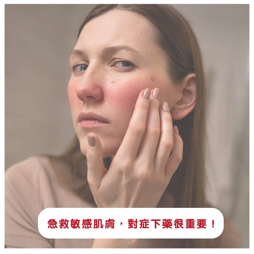 減少肌膚紅腫與敏感的技巧:皮膚科醫生教你高效舒緩泛紅肌膚