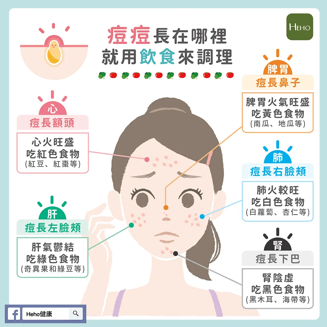 痘痘OUT！破解長痘原因與最佳對策