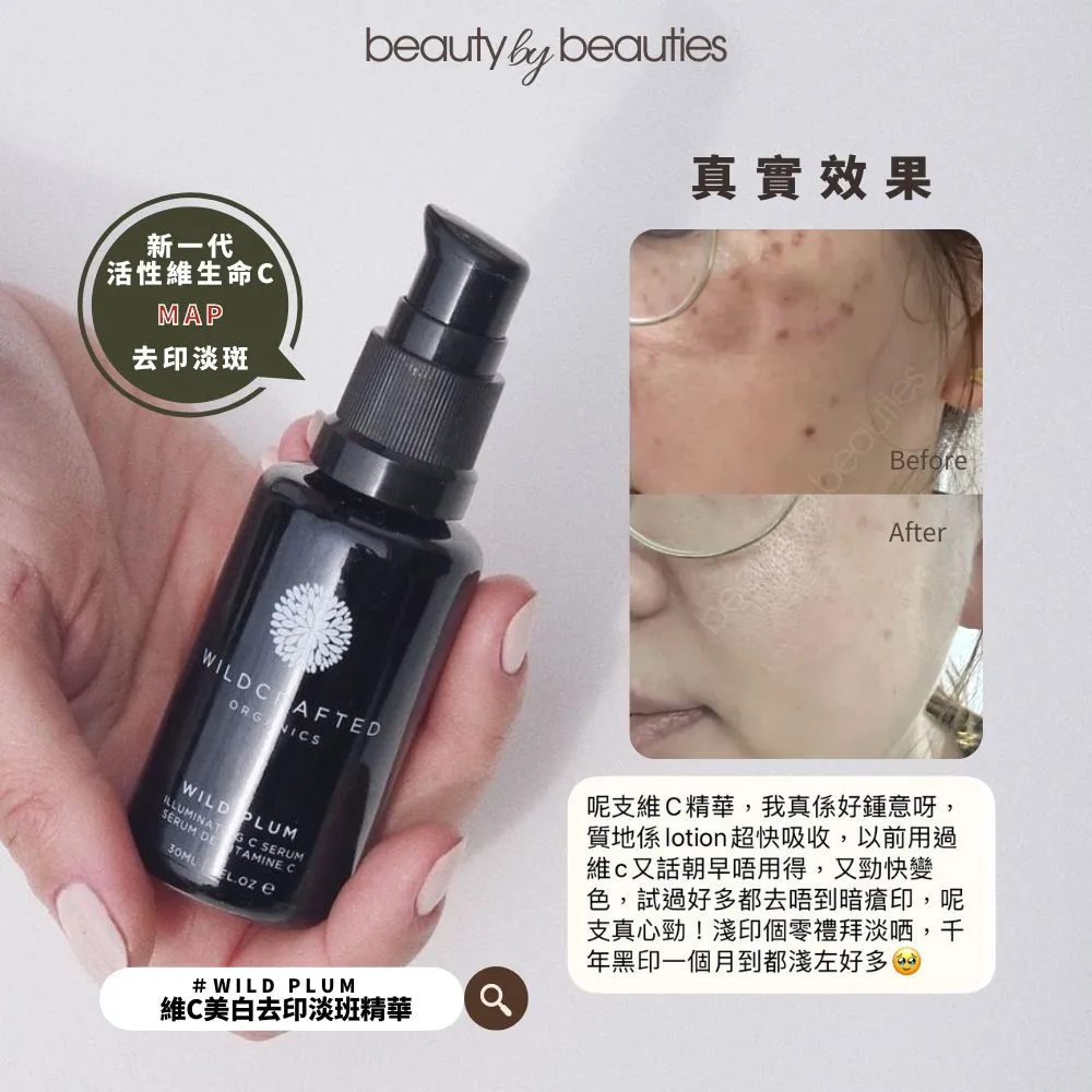 減少痘印的護膚方法：高效淡印攻略，維C、煙酰胺、A醇+防曬必學！