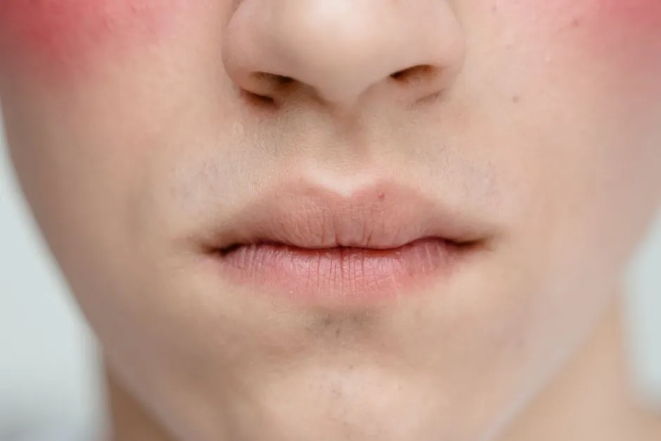 如何有效縮小毛孔?皮膚科醫生完整教學:告別粗大毛孔的科學秘訣