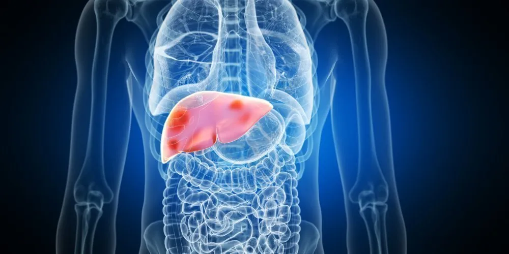 Liver Detox | www.neomedinstitute.com