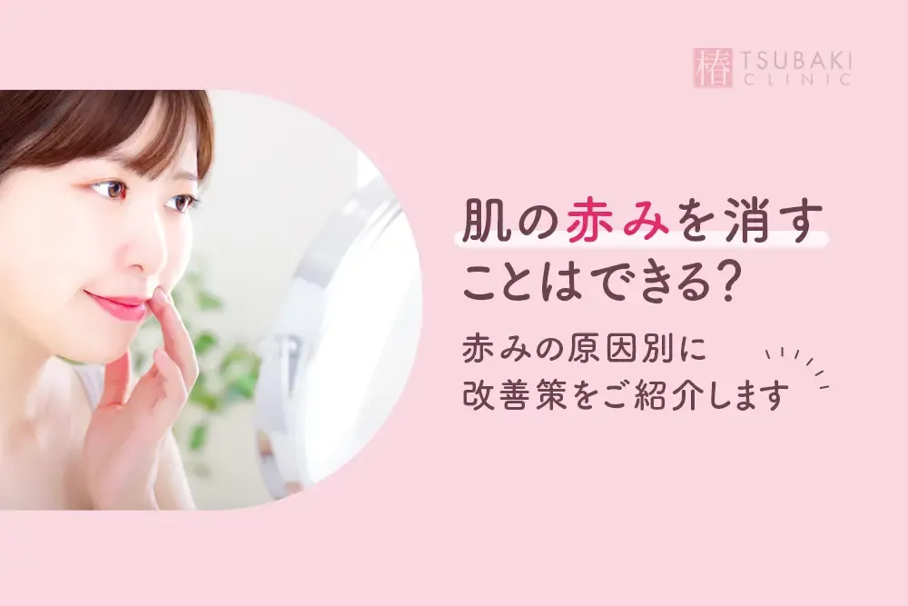 赤み肌の救世主！スキンケアで赤みを軽減する方法｜皮膚科医が解説
