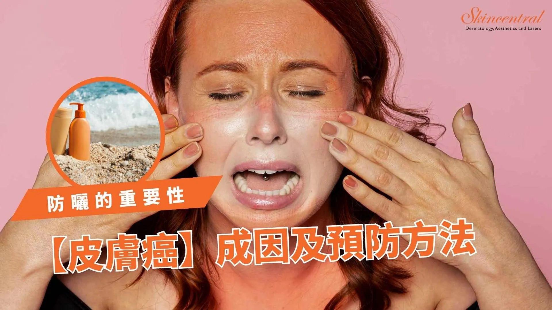 防曬在護膚日常中的重要性：高效防曬攻略，預防早衰和皮膚癌！