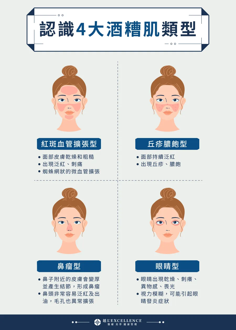 如何知道自己是不是酒糟肌？皮膚科醫生教你高效辨識酒糟肌症狀