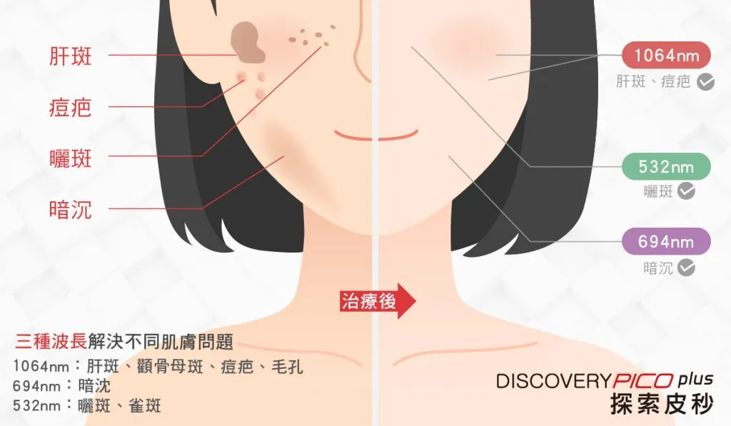 如何應對暗沉膚色？這些成分不可少！皮膚科醫生親授高效美白攻略