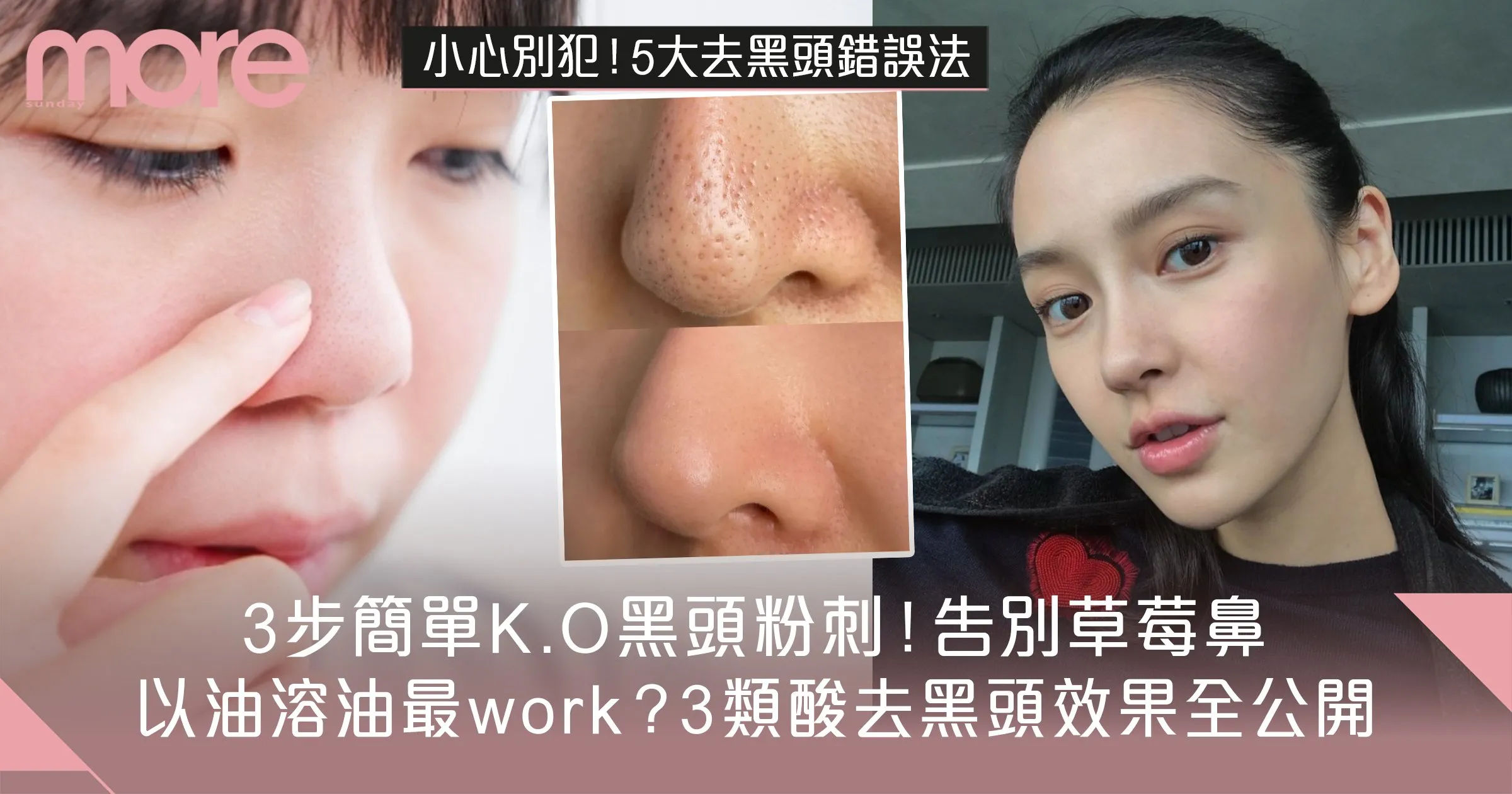 去除黑頭的方法與日常保養建議：告別黑頭，擁有淨透美肌的完整教學