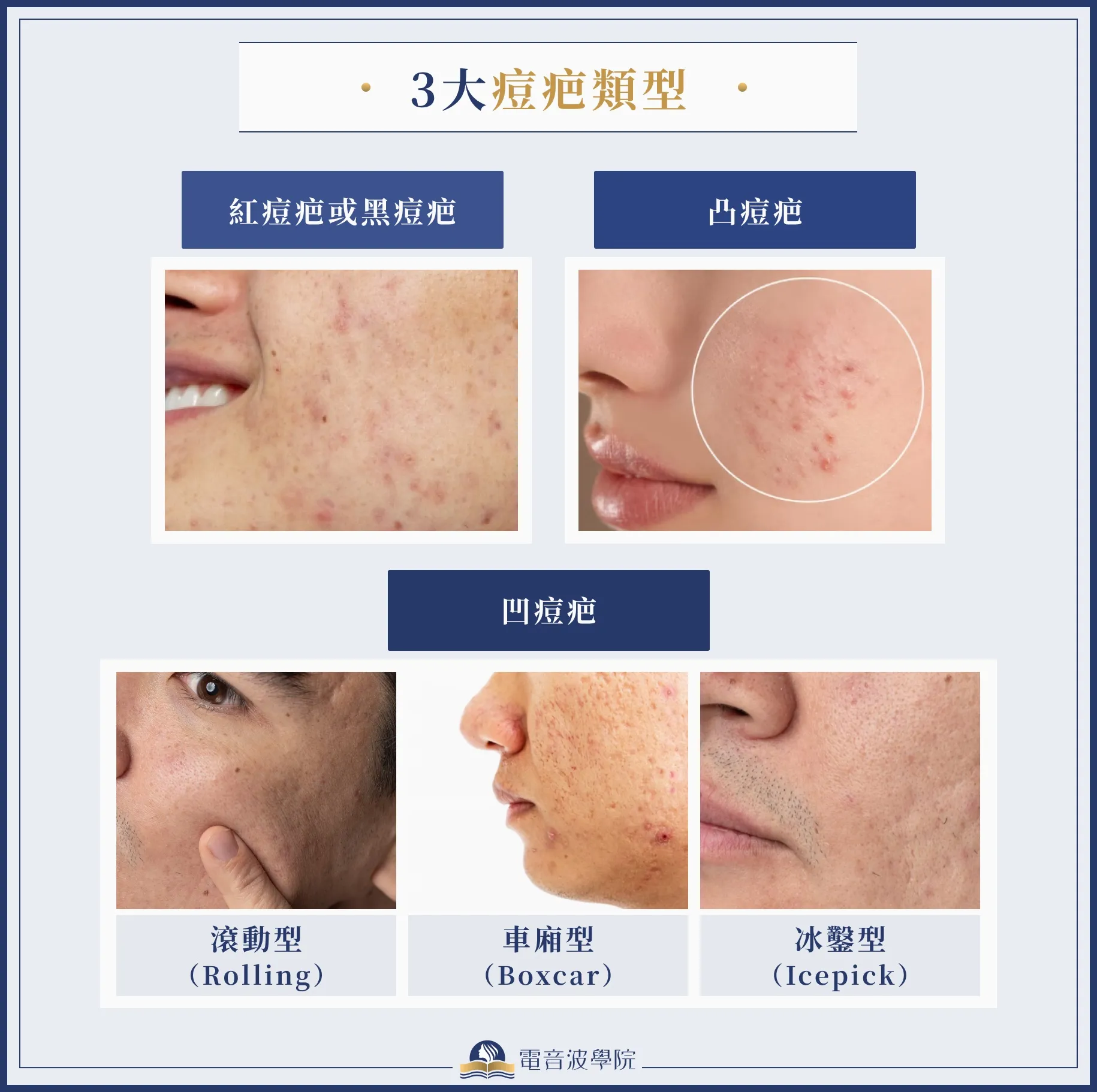 維生素C淡痘疤攻略：皮膚科醫師教你告別痘疤困擾