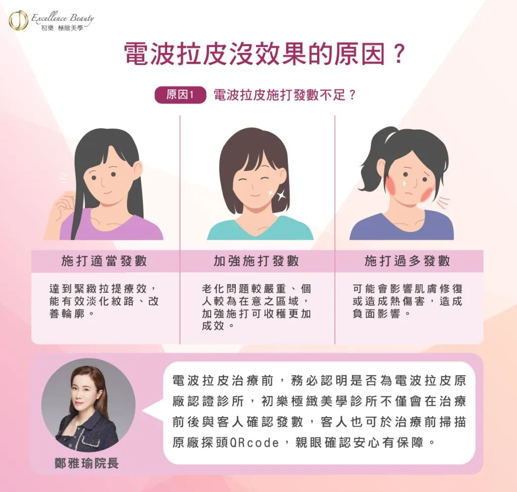 【健康肌膚守護】電波拉提術後的臉部維護：緊緻效果與維持期長短的完整教學