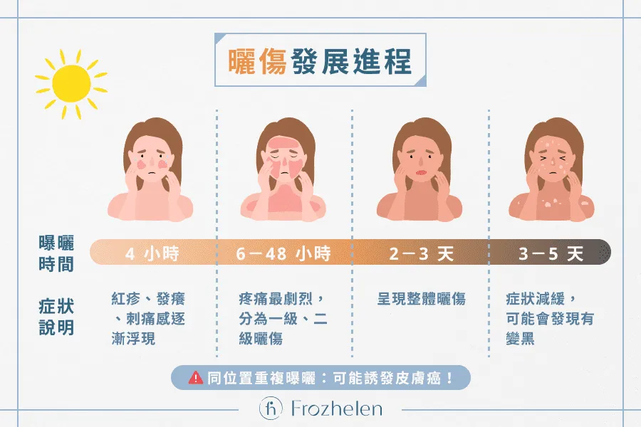 曬傷脫皮色差：高效修復指南，告別曬後瑕疵！