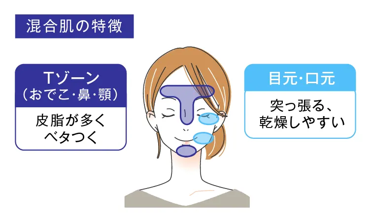 混合肌の管理方法とスキル｜効率的なケアで美肌を手に入れる！
