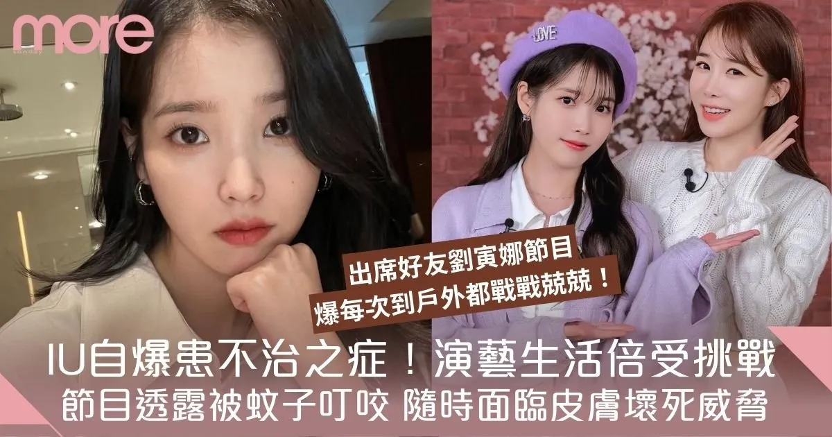 IU驚爆罹患罕見斯基特症候群！童年留疤至今，蚊蟲叮咬竟致皮膚壞死