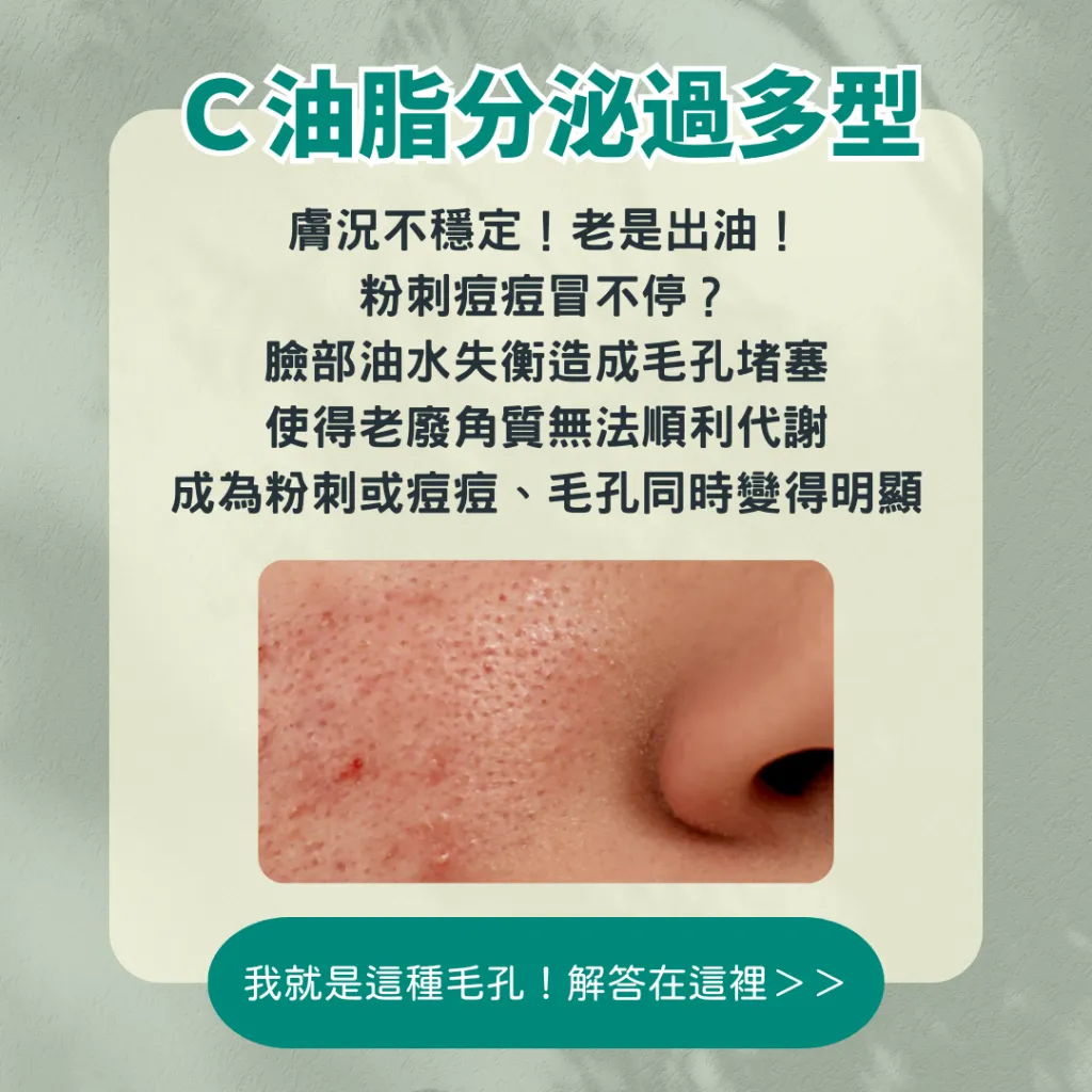 改善毛孔粗大必學指南:油脂過多、肌膚老化竟是元凶!