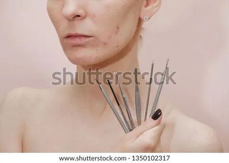 油性肌用什麼化妝水比較合適?痘痘肌控油舒緩化妝水推薦!