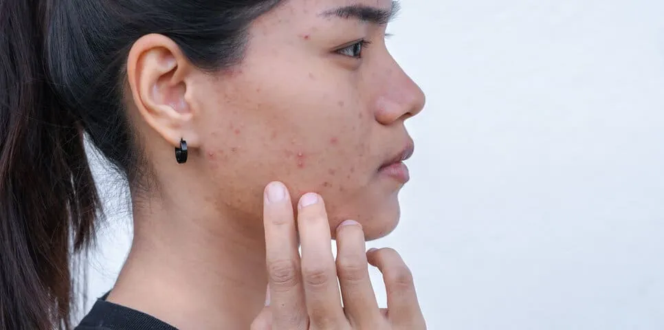 Lu.11 Beauty face 敏感肌的隱形殺手:這5種「天然」植物成分,你還在用嗎?