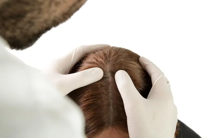 頭皮檢測