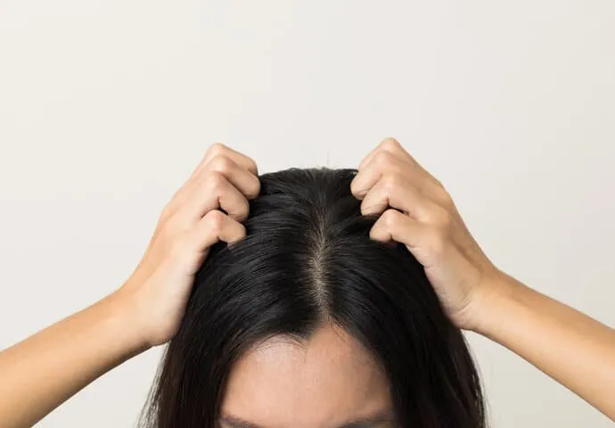 頭皮敏感