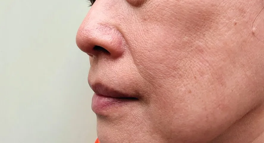 嘴角暗沉有救嗎？別讓嘴邊黑影拖垮顏值！霧唇轉色與局部遮瑕全解析