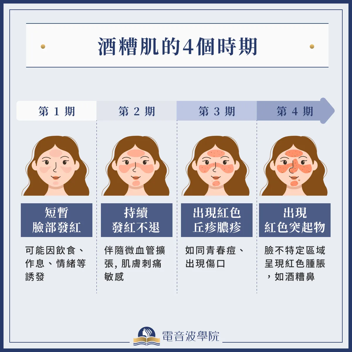 如何知道自己是不是酒糟肌?酒糟肌診斷指南與常見症狀