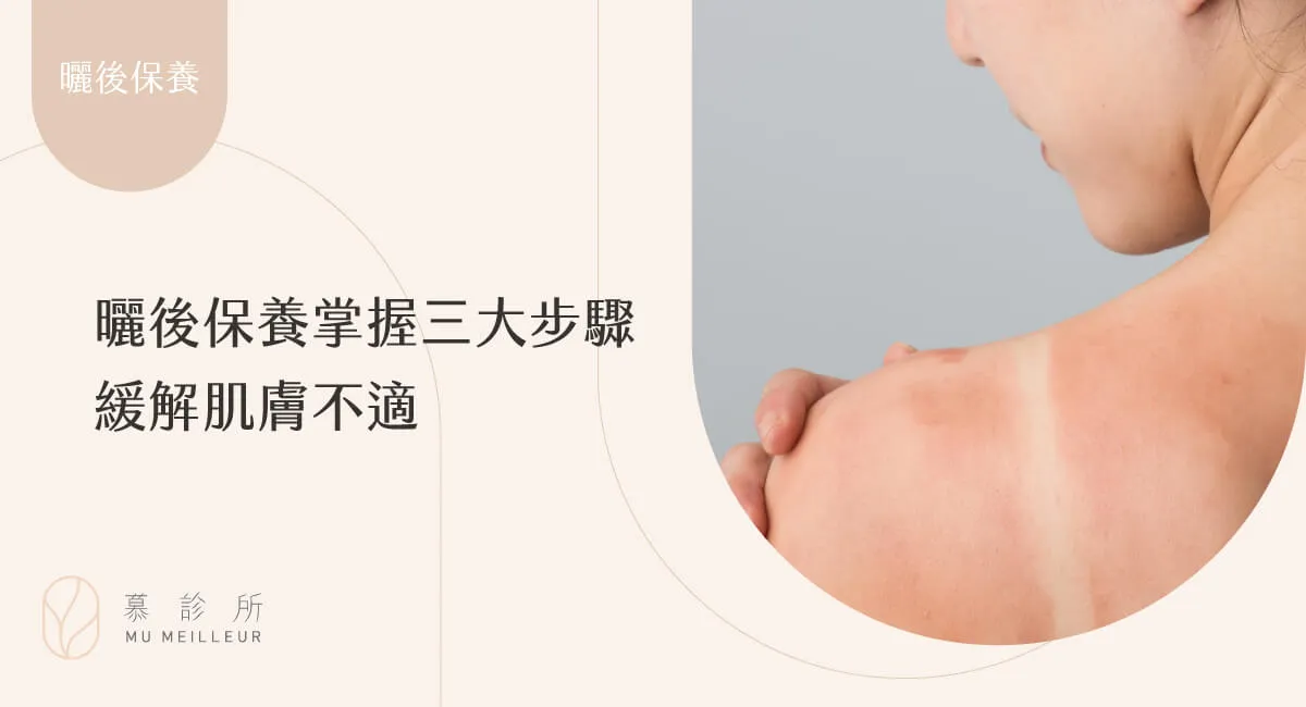 曬後修復的快速方法:舒緩泛紅乾燥肌膚的完整教學