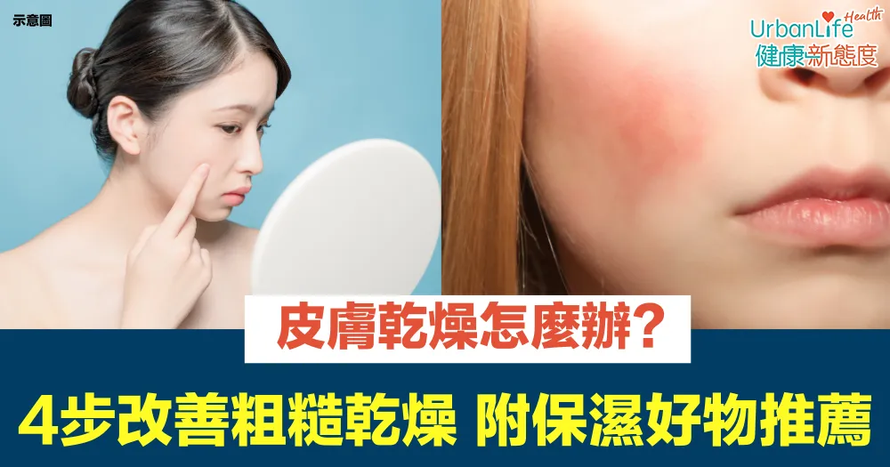 如何改善因乾燥引起的肌膚緊繃感?高效保濕秘訣與產品推薦