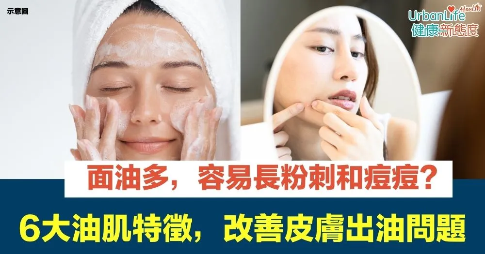 如何選擇適合油性肌的控油精華？痘痘肌膚控油精華高效選擇指南