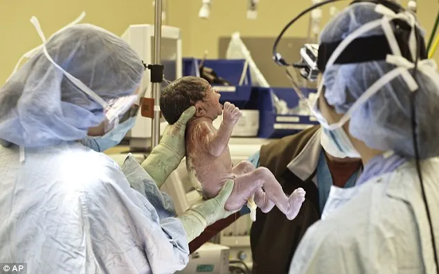 Live caesarean section is witnessed by thousands of Twitter users ...