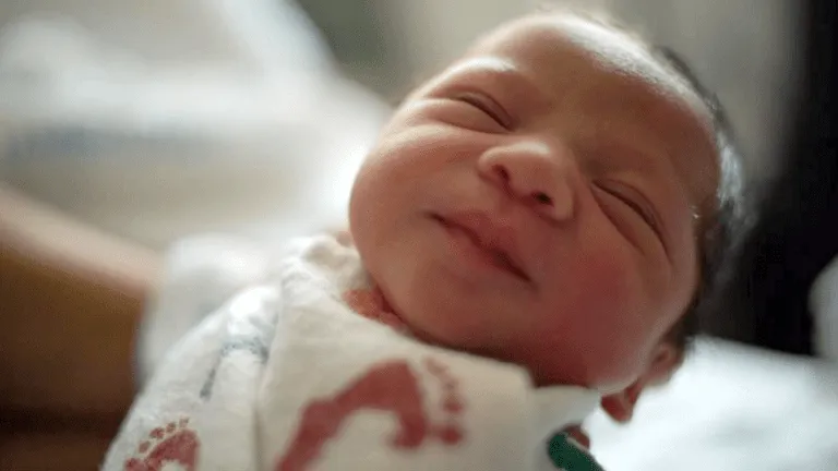 Live birth: Epidural