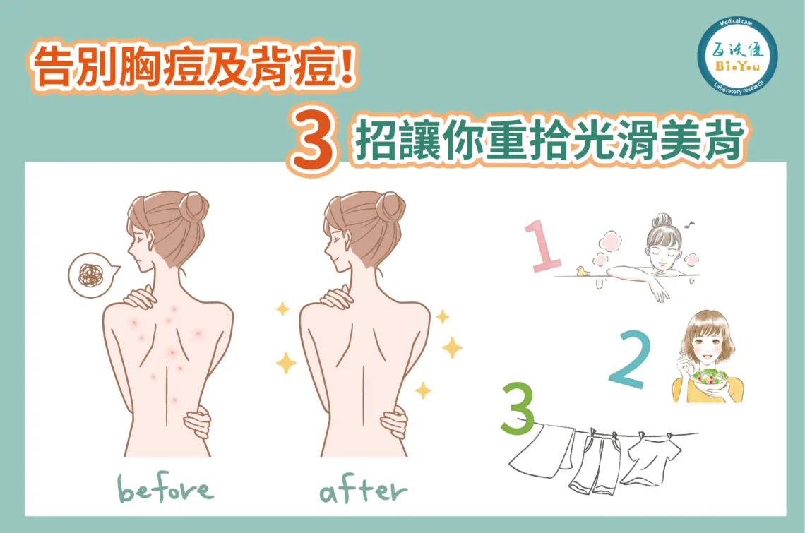 夏日背部防曬與背痘護理法:告別痘痘,擁有自信美背!
夏日美背秘笈:防曬+護理,擺脫背痘困擾!