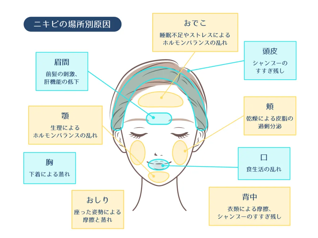 ニキビ肌に最適な成分とは?|皮膚科医が教えるニキビ治療の秘訣