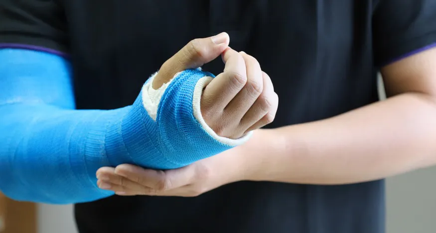 How to Use a Dip Station for Arm Recovery
