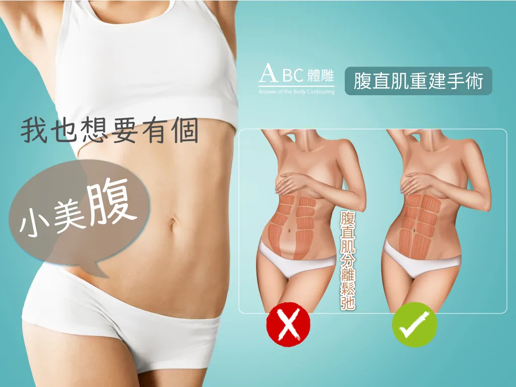 受傷後增肌的循環訓練攻略:Is Circuit Training Suitable for Post-Injury Muscle Building?